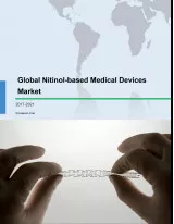 Global Nitinol-based Medical Devices Market 2017-2021